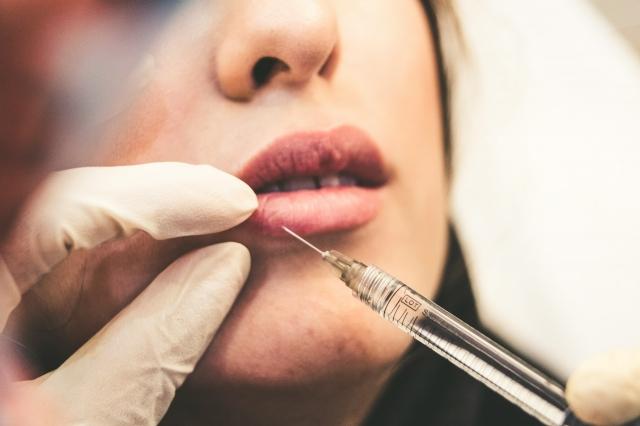 Sonobello: A Comprehensive Guide to the Popular Cosmetic Procedure