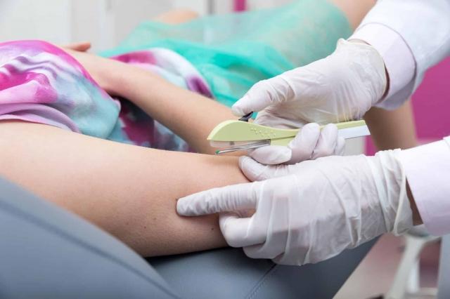 Understanding Contraceptive Implants: A Comprehensive Guide for Teens
