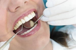 How Do You Prevent Gum Disease?